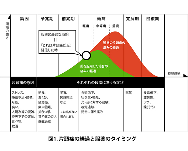 片頭痛の原因の図